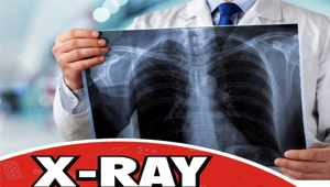 x-ray